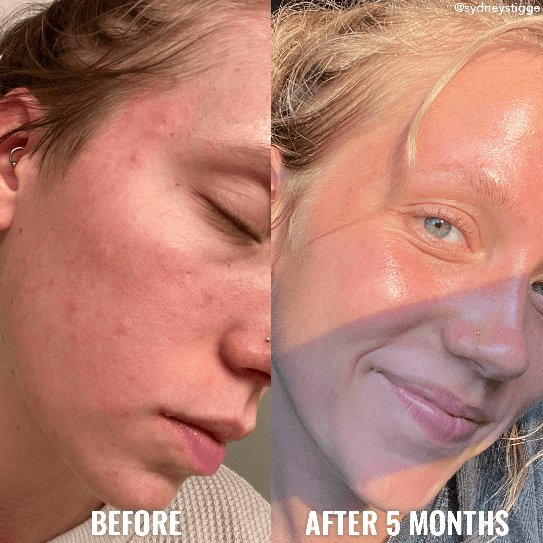see a difference in your skin